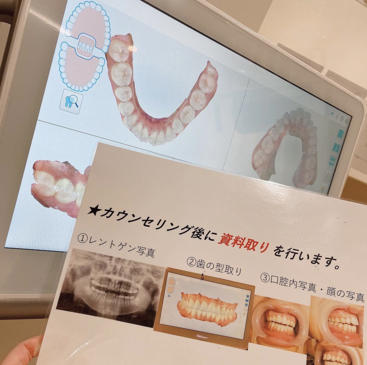 当院の歯列矯正無料カウンセリングについて | 大阪市北区 大深町