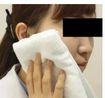 蒸しタオルによる温罨法