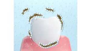 UFB